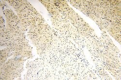 GTF2IRD1 Rabbit anti-Human, Mouse, Rat, Polyclonal, Proteintech:Antibodies:Primary