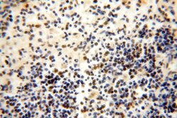 GTF2IRD1 Rabbit anti-Human, Mouse, Rat, Polyclonal, Proteintech:Antibodies:Primary