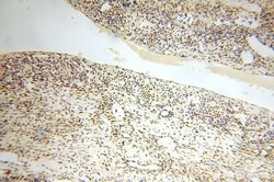 GTF2IRD1 Rabbit anti-Human, Mouse, Rat, Polyclonal, Proteintech:Antibodies:Primary