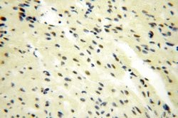 GTF2IRD1 Rabbit anti-Human, Mouse, Rat, Polyclonal, Proteintech:Antibodies:Primary