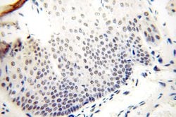 GTF2IRD1 Rabbit anti-Human, Mouse, Rat, Polyclonal, Proteintech:Antibodies:Primary