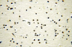 GTF2IRD1 Rabbit anti-Human, Mouse, Rat, Polyclonal, Proteintech:Antibodies:Primary