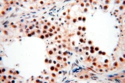 GTF2IRD1 Rabbit anti-Human, Mouse, Rat, Polyclonal, Proteintech:Antibodies:Primary