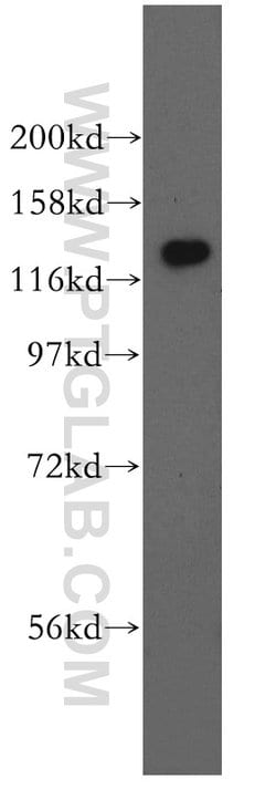 GTF2IRD1 Rabbit anti-Human, Mouse, Rat, Polyclonal, Proteintech:Antibodies:Primary