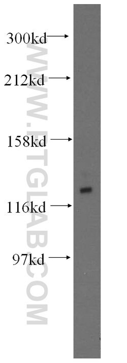 GTF2IRD1 Rabbit anti-Human, Mouse, Rat, Polyclonal, Proteintech:Antibodies:Primary