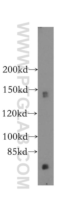GTF2IRD1 Rabbit anti-Human, Mouse, Rat, Polyclonal, Proteintech:Antibodies:Primary