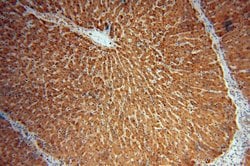 TCTN2 Rabbit anti-Human, Mouse, Rat, Polyclonal, Proteintech 150 &mu;L;