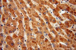 TCTN2 Rabbit anti-Human, Mouse, Rat, Polyclonal, Proteintech 150 &mu;L;