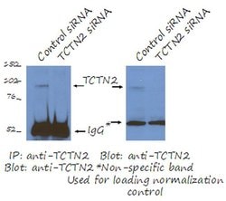 TCTN2 Rabbit anti-Human, Mouse, Rat, Polyclonal, Proteintech 150 &mu;L;