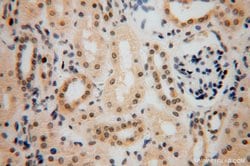 LARP7 Rabbit anti-Human, Mouse, Rat, Polyclonal, Proteintech 150 &mu;L;