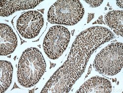 TEX12 Rabbit anti-Human, Mouse, Rat, Polyclonal, Proteintech 150 &mu;L;