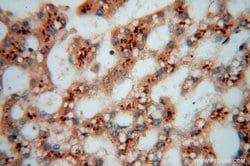 TEX12 Rabbit anti-Human, Mouse, Rat, Polyclonal, Proteintech 150 &mu;L;