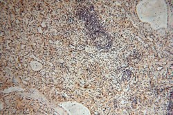 TEX12 Rabbit anti-Human, Mouse, Rat, Polyclonal, Proteintech 150 &mu;L;