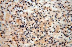 TEX12 Rabbit anti-Human, Mouse, Rat, Polyclonal, Proteintech 150 &mu;L;