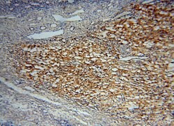 TEX12 Rabbit anti-Human, Mouse, Rat, Polyclonal, Proteintech 150 &mu;L;