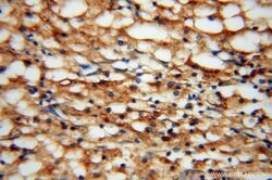 TEX12 Rabbit anti-Human, Mouse, Rat, Polyclonal, Proteintech 150 &mu;L;