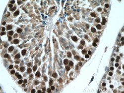 TEX12 Rabbit anti-Human, Mouse, Rat, Polyclonal, Proteintech 150 &mu;L;