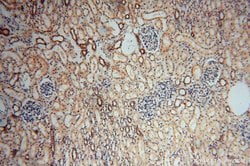 TEX12 Rabbit anti-Human, Mouse, Rat, Polyclonal, Proteintech 150 &mu;L;