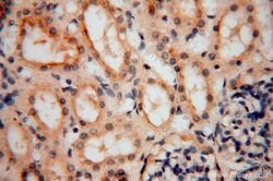 TEX12 Rabbit anti-Human, Mouse, Rat, Polyclonal, Proteintech 150 &mu;L;
