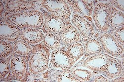 TEX12 Rabbit anti-Human, Mouse, Rat, Polyclonal, Proteintech 150 &mu;L;