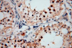TEX12 Rabbit anti-Human, Mouse, Rat, Polyclonal, Proteintech 150 &mu;L;