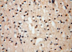 TEX12 Rabbit anti-Human, Mouse, Rat, Polyclonal, Proteintech 150 &mu;L;