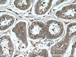 TEX12 Rabbit anti-Human, Mouse, Rat, Polyclonal, Proteintech 150 &mu;L;
