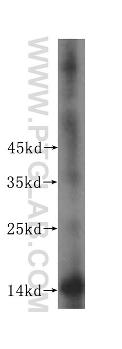 TEX12 Rabbit anti-Human, Mouse, Rat, Polyclonal, Proteintech 150 &mu;L;