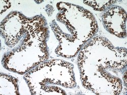 LZTFL1 Rabbit anti-Human, Mouse, Rat, Polyclonal, Proteintech:Antibodies:Primary