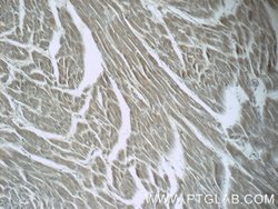 LZTFL1 Rabbit anti-Human, Mouse, Rat, Polyclonal, Proteintech:Antibodies:Primary