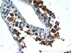 LZTFL1 Rabbit anti-Human, Mouse, Rat, Polyclonal, Proteintech:Antibodies:Primary