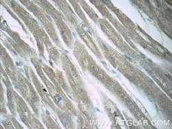 LZTFL1 Rabbit anti-Human, Mouse, Rat, Polyclonal, Proteintech:Antibodies:Primary