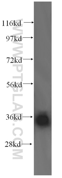 LZTFL1 Rabbit anti-Human, Mouse, Rat, Polyclonal, Proteintech:Antibodies:Primary