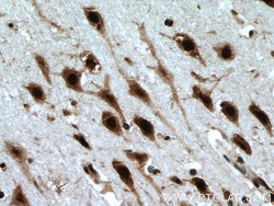 LUC7L Rabbit anti-Human, Mouse, Rat, Polyclonal, Proteintech 150 &mu;L;