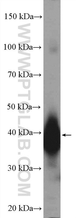 LUC7L Rabbit anti-Human, Mouse, Rat, Polyclonal, Proteintech 150 &mu;L;