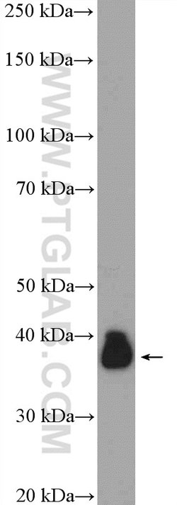 LUC7L Rabbit anti-Human, Mouse, Rat, Polyclonal, Proteintech 150 &mu;L;