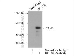 DCTN4 Rabbit anti-Human, Mouse, Rat, Polyclonal, Proteintech:Antibodies:Primary