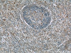 GNPDA2 Rabbit anti-Human, Mouse, Rat, Polyclonal, Proteintech:Antibodies:Primary