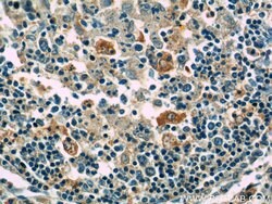 GNPDA2 Rabbit anti-Human, Mouse, Rat, Polyclonal, Proteintech:Antibodies:Primary