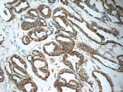 GNPDA2 Rabbit anti-Human, Mouse, Rat, Polyclonal, Proteintech:Antibodies:Primary