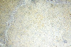 OGDHL Rabbit anti-Human, Mouse, Rat, Polyclonal, Proteintech:Antibodies:Primary