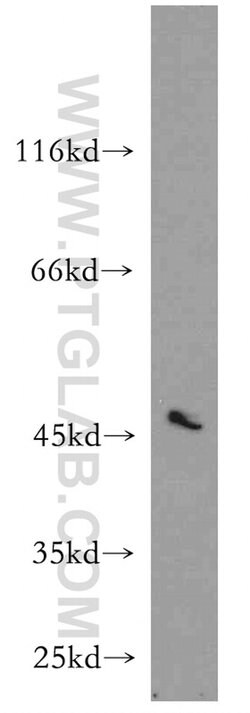RUNDC3B Rabbit anti-Human, Mouse, Rat, Polyclonal, Proteintech:Antibodies:Primary