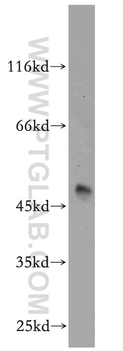 RUNDC3B Rabbit anti-Human, Mouse, Rat, Polyclonal, Proteintech:Antibodies:Primary
