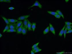 UPF3A Rabbit anti-Human, Polyclonal, Proteintech 150 &mu;L | Buy Online | Proteintech Group Inc | Fisher Scientific