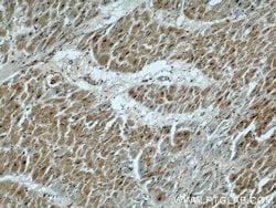 UPF3A Rabbit anti-Human, Polyclonal, Proteintech 150 &mu;L | Buy Online | Proteintech Group Inc | Fisher Scientific