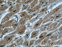 UPF3A Rabbit anti-Human, Polyclonal, Proteintech 150 &mu;L | Buy Online | Proteintech Group Inc | Fisher Scientific