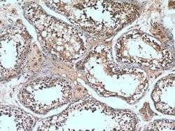 UPF3A Rabbit anti-Human, Polyclonal, Proteintech 150 &mu;L | Buy Online | Proteintech Group Inc | Fisher Scientific