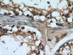 UPF3A Rabbit anti-Human, Polyclonal, Proteintech 150 &mu;L | Buy Online | Proteintech Group Inc | Fisher Scientific