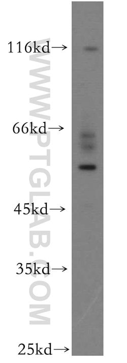 UPF3A Rabbit anti-Human, Polyclonal, Proteintech 150 &mu;L | Buy Online | Proteintech Group Inc | Fisher Scientific