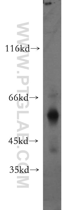 UPF3A Rabbit anti-Human, Polyclonal, Proteintech 150 &mu;L | Buy Online | Proteintech Group Inc | Fisher Scientific